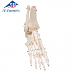 발 골격 관절 Foot and Ankle Skeleton A31 / 철사로고정 / Item: 1019357 [A31]