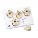 척추뼈 요추 인체 모형