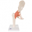 고급형 엉덩이관절 (고관절) 인체 모형