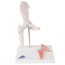 소형 고관절 인체 모형