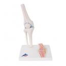 미니 무릎관절 인체 모형