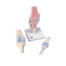 무릎관절 단면 인체 모형