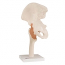 엉덩이관절(고관절) 인체 모형