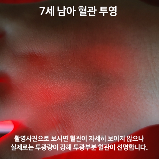 [가격인하] 소아/유아 혈관 네비게이션 정맥진단기