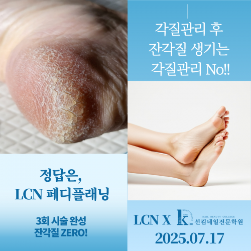 "3회 시술 완성 잔각질 ZERO"  LCN 페디플레닝 세미나