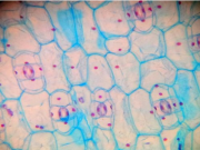 자주달개비잎 영구프레파라트(앞면,뒷면) smg