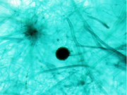누룩곰팡이 슬라이드표본 smn