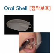 진료시 뺨 보호! 오랄쉘
