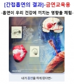 간접흡연의 결과(M78925KO) *한글설명서 스티커 제공 / 각종 질병 모형 / 금연교육 / 보건교육