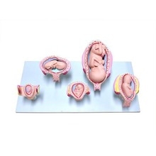 [성교육] 태아발달모형 5P (KIM-M0013-2) / 실물 사이즈 제작 / 1개월, 3개월, 4개월, 5개월, 7개월 태아의 모형