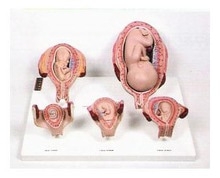 [성교육] 태아발육과정 A형 (KIM1-25) / 실물 사이즈 제작 / 1개월, 2개월, 3개월, 5개월, 7개월 태아의 모형