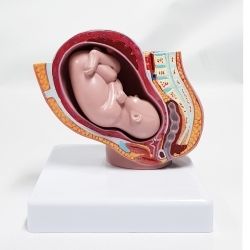 (미니)성숙아와 임신골반(kim3-4005) / 골반자궁과 9개월 임신태아