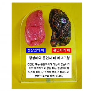 금연교육-미니 정상폐와 흡연자폐 입체모형 (kim3-135)