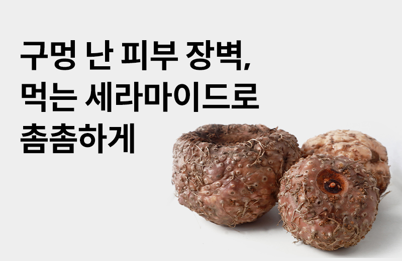 이전글