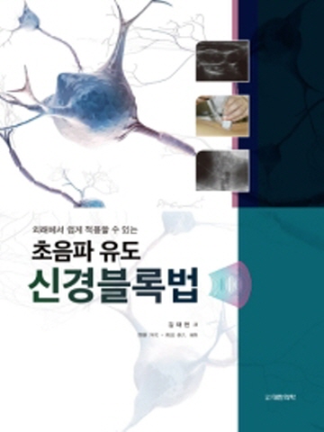 외래에서 쉽게 적용할 수 있는 초음파 유도 신경블록법