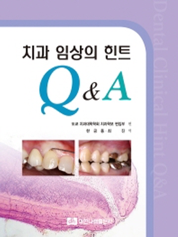 치과 임상의 힌트 Q&A