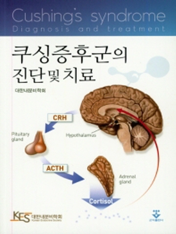 쿠싱증후군의 진단 및 치료