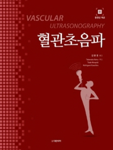 혈관초음파(Vascular Ultrasonography)