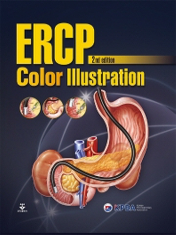 ERCP Color Illustration [제2판]