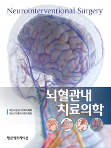 뇌혈관내치료의학(양장본)