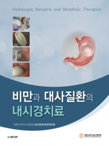 비만과 대사질환의 내시경치료