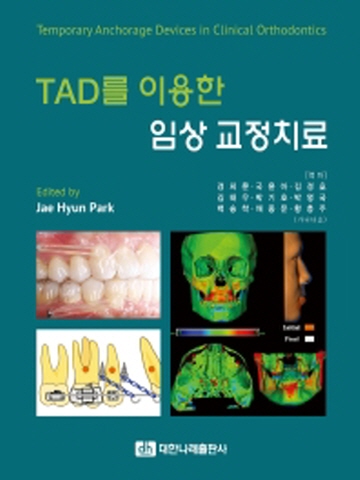 TAD를 이용한 임상 교정치료