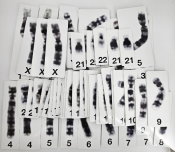 교사용(칠판용) 핵형