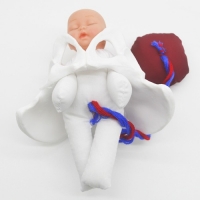 탯줄 태반이 있는 태아 출산 교육모형R