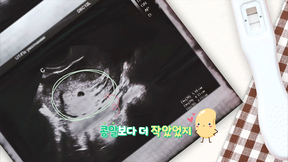 Beansong : 콩알송