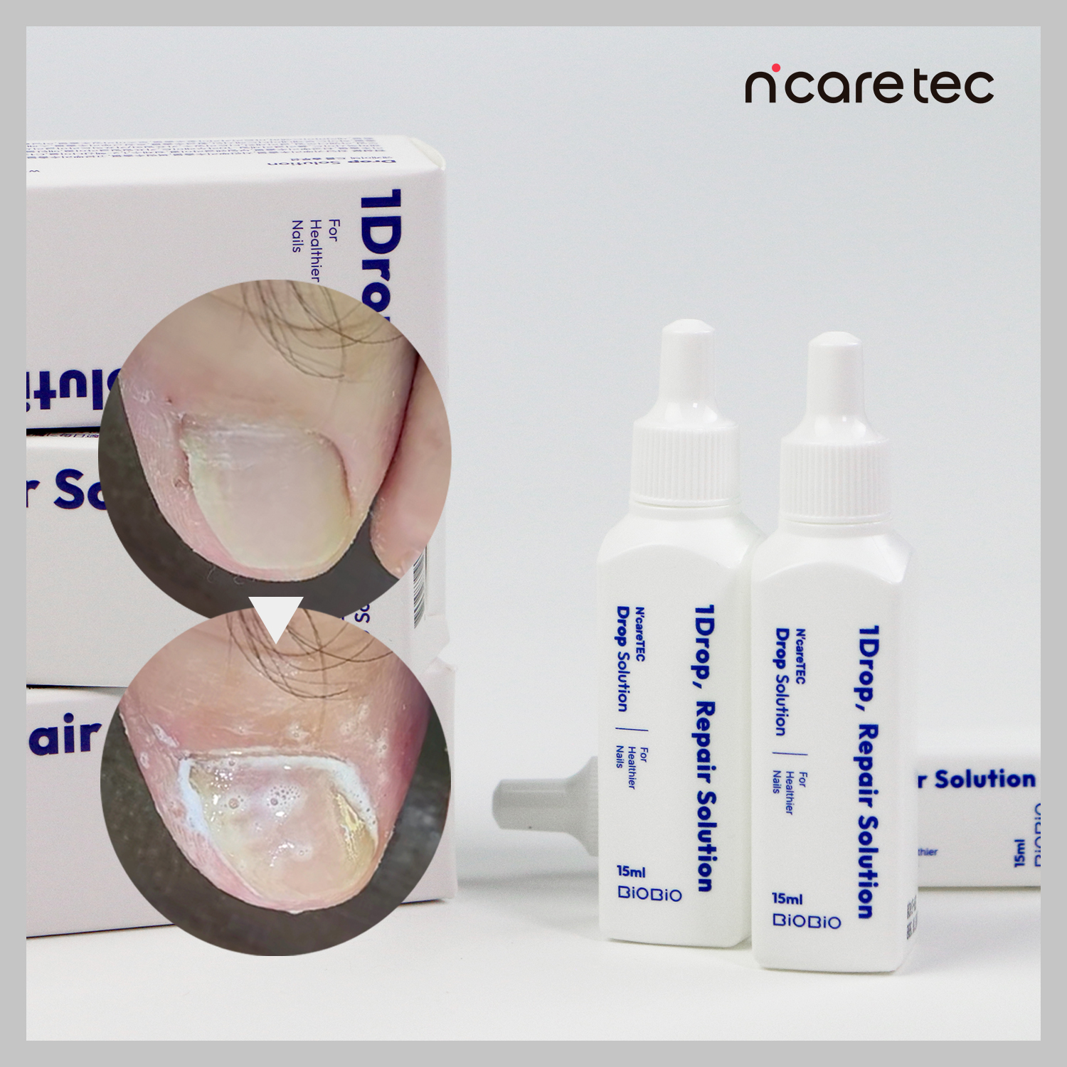 [프로모션] 데일리케어 문제성손발톱영양제 드롭솔루션