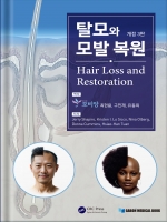 탈모와 모발 복원-개정3판 (Hair Loss and Restoration)