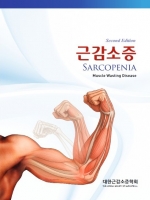 근감소증, 2판