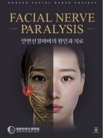 안면신경마비의 원인과 치료