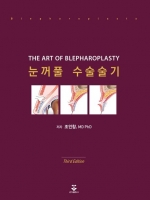 눈꺼풀 수술술기, 3판 (The Art of Blepharoplasty)